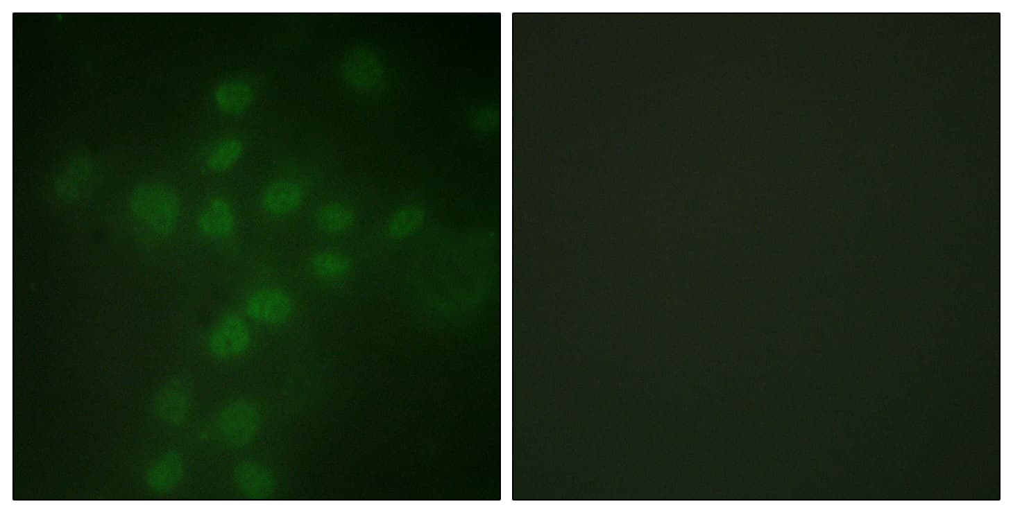 TERT / Telomerase Antibody (phospho-Ser227)