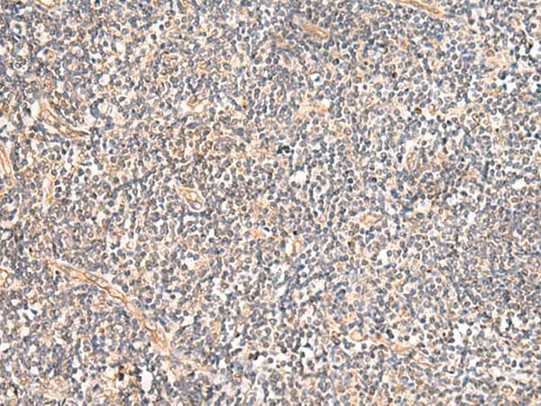 Polyclonal Rabbit anti-Human MRPL16 Antibody (IHC)