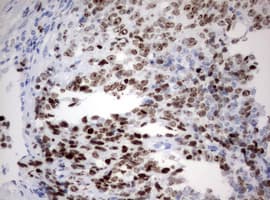 Monoclonal Mouse anti-Human MKI67 / Ki67 Antibody (clone OTI14G1, aa1160-1493, IHC)