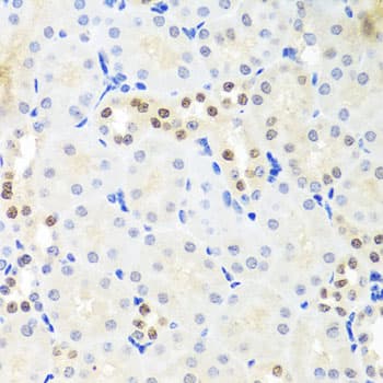 Polyclonal Rabbit anti-Human DDX39 Antibody (IHC, WB)