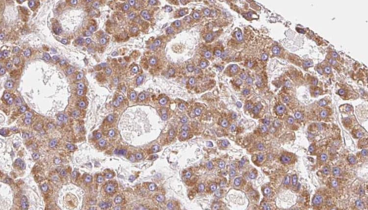 OR6C75 Antibody