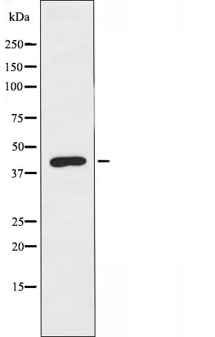 OXER1 Antibody