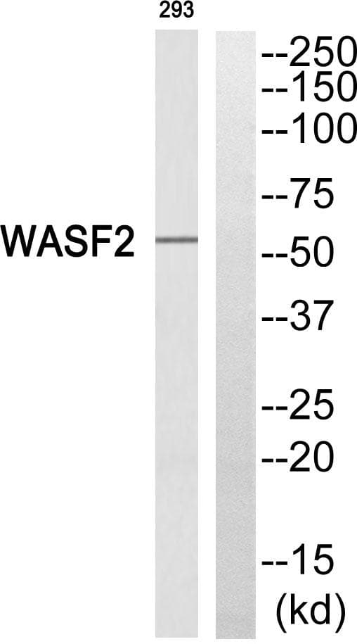 Polyclonal Rabbit anti-Human WASF2 / SCAR2 Antibody (IHC, WB)
