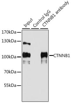 Polyclonal Rabbit anti-Human CTNNB1 / Beta Catenin Antibody (IHC, WB)