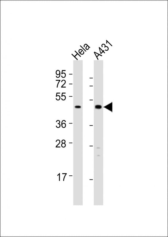 TGFB4 / LEFTY2 Antibody