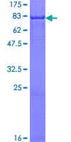Human CAMK2B / CaMKII Beta Protein (Recombinant GST)