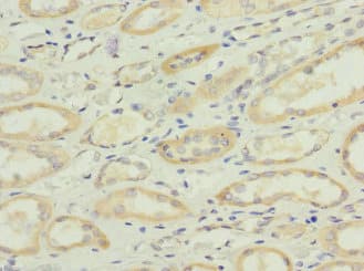 Polyclonal Rabbit anti-Human SQRDL Antibody (IHC, WB)