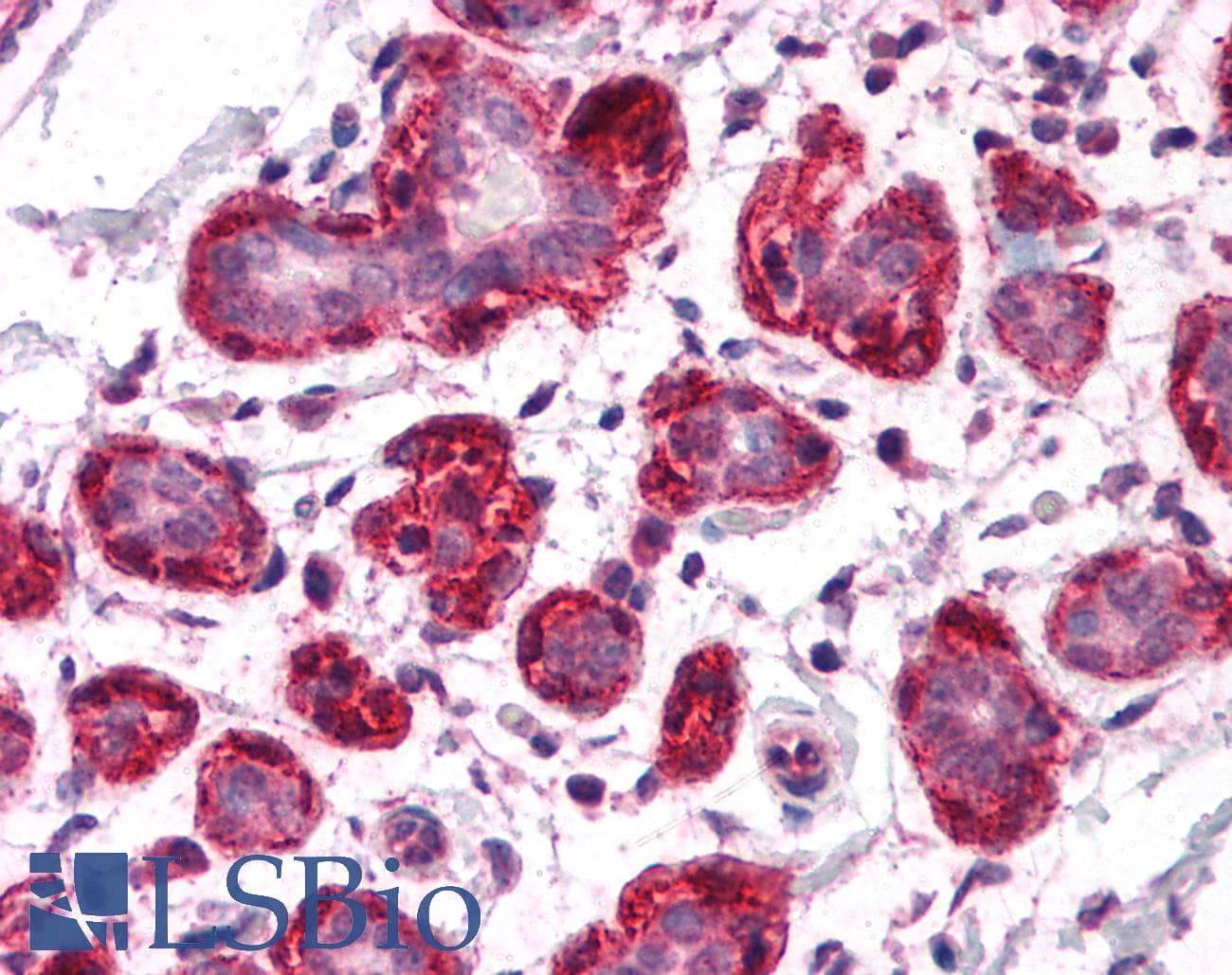 IHC-plus™ SH3BP4 Antibody