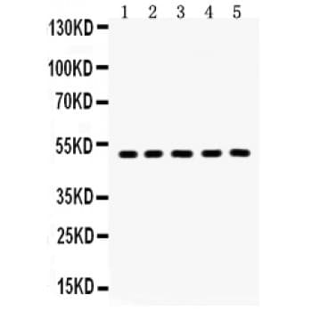 AQP2 / Aquaporin 2 Antibody (aa241-271)