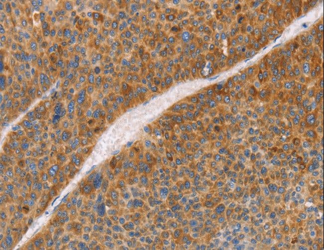 FGL1 / Hepassocin Antibody