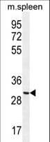 Polyclonal Rabbit anti-Human CCDC84 Antibody (aa34-62, IHC, WB)
