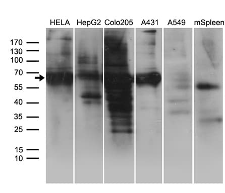 GRB7 Antibody (clone OTI15E7)