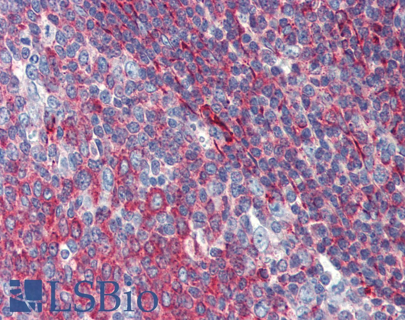 Polyclonal Rabbit anti-Human PHACTR1 Antibody (aa468-517, IHC, WB)