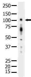 PRKD1 / PKC Mu Antibody (Gly459)