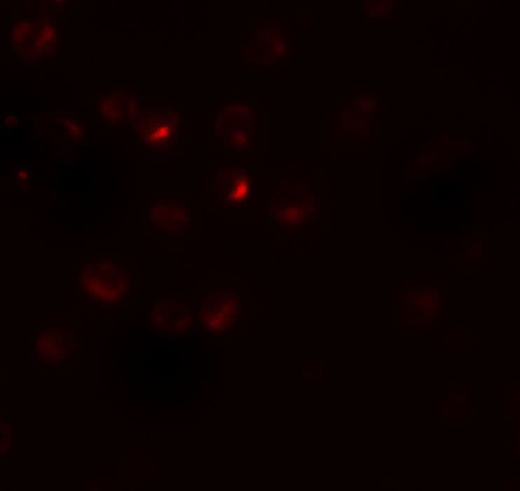 RSPO3 Antibody