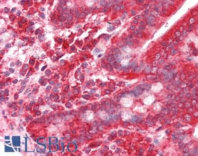 IHC-plus™ ITGAE / CD103 Antibody