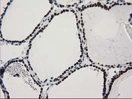 CTDSP1 / SCP1 Antibody (clone OTI1G1)