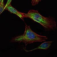 Monoclonal Mouse anti-Human RICTOR Antibody (clone 7B3, IHC, IF, WB)