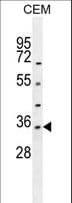 LDHAL6A Antibody (aa154-183)