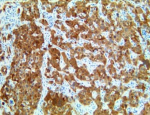 p16INK4a / CDKN2A Antibody (clone RBT-p16)