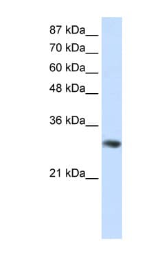 GNB2L1 / RACK1 Antibody (C-Terminus)