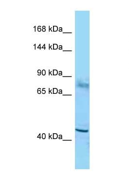 TSHZ2 Antibody (aa141-190)