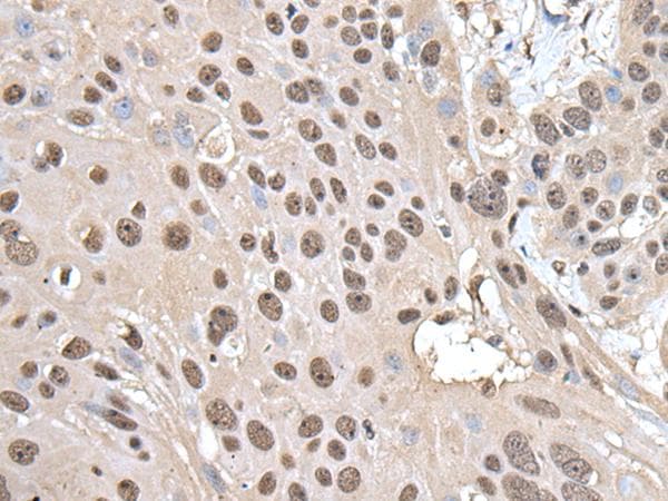SMC1A / SMC1 Antibody