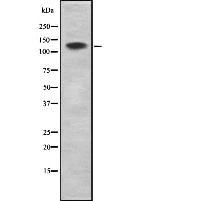 Polyclonal Rabbit anti-Human CACNA2D1 Antibody (WB)