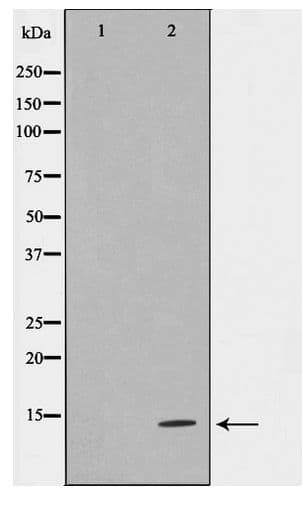 TUSC2 / FUS1 Antibody