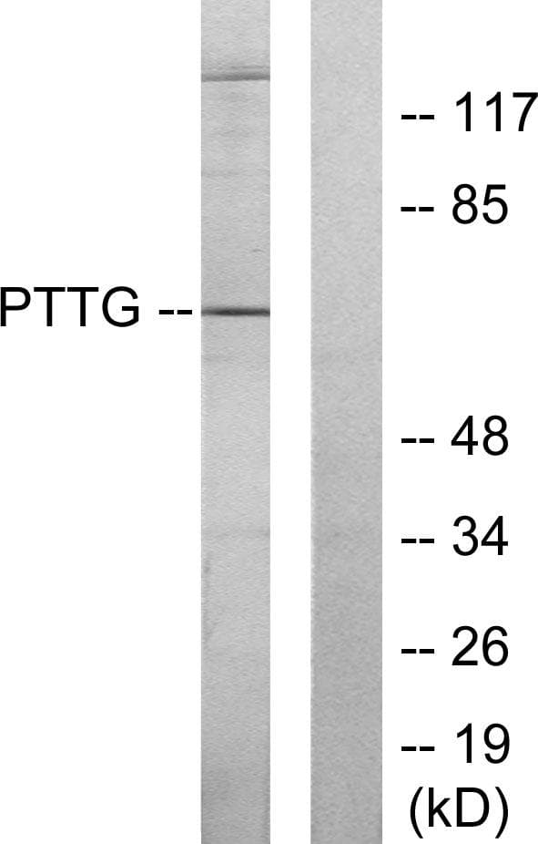 Polyclonal Rabbit anti-Human PTTG1IP / PBF Antibody (IHC, WB)