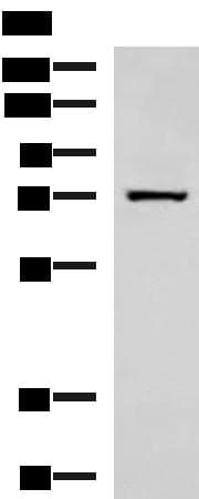 SHOOTIN1 / KIAA1598 Antibody