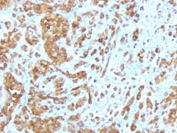 MLANA / Melan-A Antibody (clone MLANA/788)