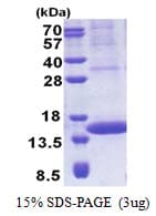 Human PIP / GCDFP-15 Protein (Recombinant His)