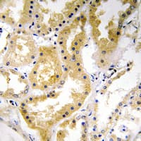 ABHD4 Antibody (C-Terminus)