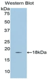 EGF Antibody (aa609-751)