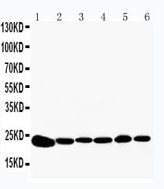 PRDX2 / Peroxiredoxin 2 Antibody (aa181-198)
