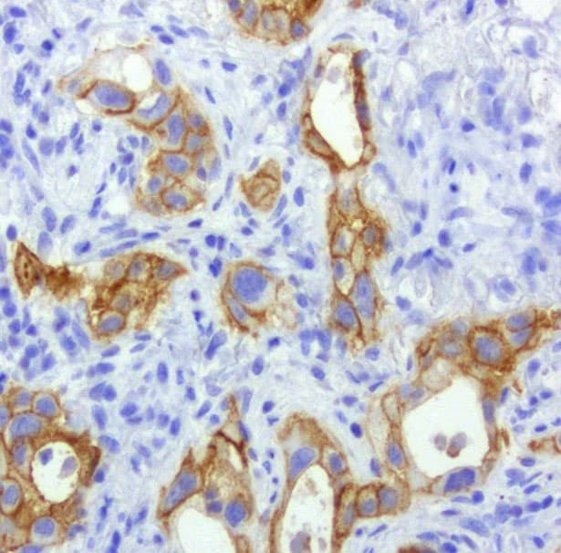 Monoclonal Mouse anti-Human EGFR Antibody (clone UMAB95, Carrier-free, IHC, IF, WB)