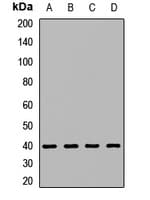 Polyclonal Rabbit anti-Human ERVFRD-1 / HERV-FRD Antibody (WB)