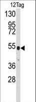 Polyclonal Rabbit V5 Tag Antibody (WB)