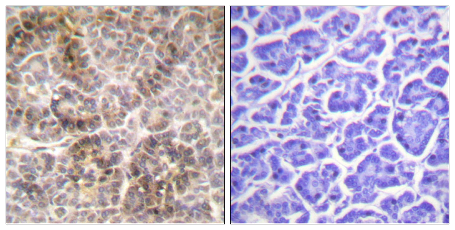 Ezrin + Radixin + Moesin Antibody (phospho-Thr558)