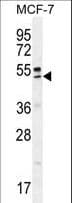 QTRTD1 Antibody (aa321-350)