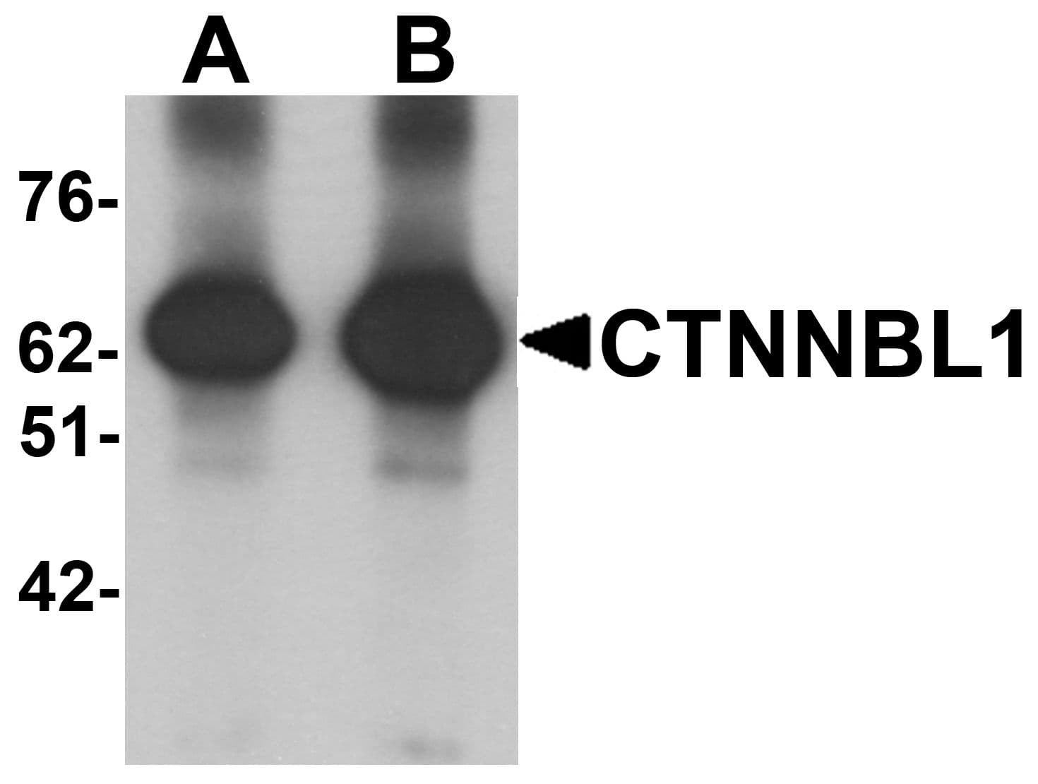 IHC-plus™ CTNNBL1 / NAP Antibody