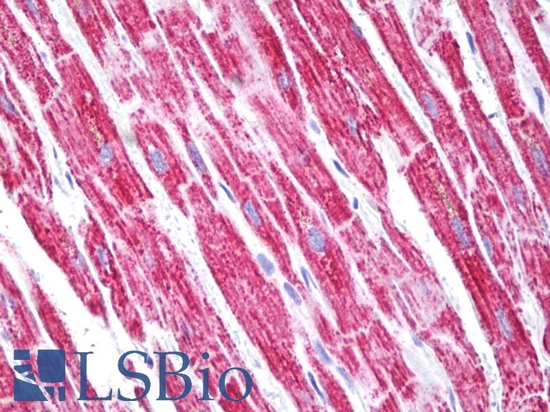 IHC-plus™ Polyclonal Rabbit anti-Human NDUFA4 Antibody (aa32-81, IHC, WB)