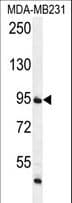 FTSJ3 Antibody (aa616-646)