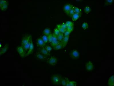 Polyclonal Rabbit anti-Human AS3MT Antibody (IHC, IF)