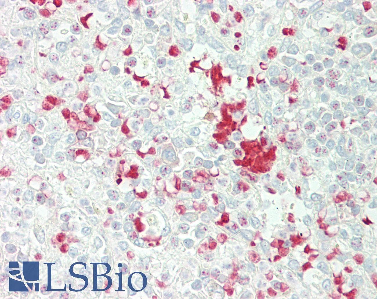 IHC-plus™ FBXL5 / FBL5 Antibody (aa510-691)