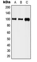 Polyclonal Rabbit anti-Human NRG1 / Heregulin / Neuregulin Antibody (N-Terminus, WB)