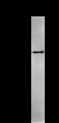 Monoclonal Mouse anti-Human CARD8 / Cardinal / TUCAN Antibody (clone 2108C2a, IF, WB)