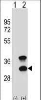 CD79B / CD79 Beta Antibody (aa93-121)