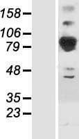 SEPT6 / Septin 6 Protein (Over-Expression Lysate Myc-DDK (Flag))